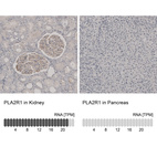 Anti-PLA2R1 Antibody