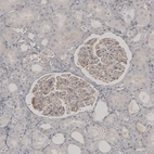 Immunohistochemical staining of human kidney shows weak membranous positivity in cells in glomeruli.