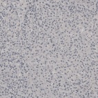 Anti-PLA2R1 Antibody