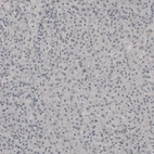 Immunohistochemical staining of human pancreas shows no positivity in exocrine glandular cells as expected.