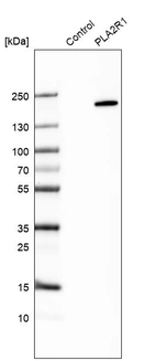 Western blot analysis in control (vector only transfected HEK293T lysate) and PLA2R1 over-expression lysate (Co-expressed with a C-terminal myc-DDK tag (~3.1 kDa) in mammalian HEK293T cells, LY423477).