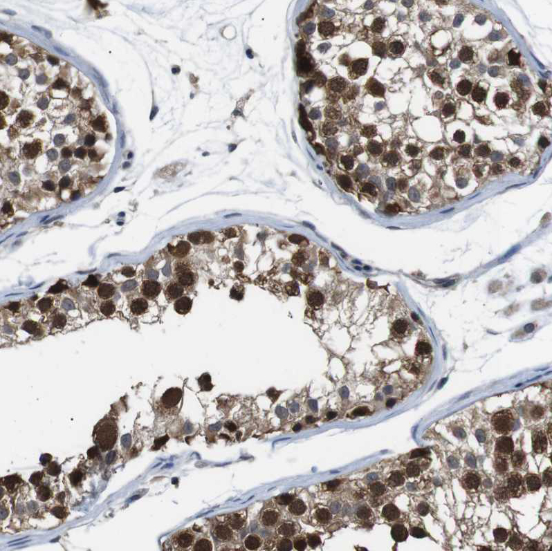 Anti-UBXN1 Antibody