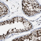 Anti-UBXN1 Antibody