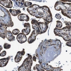 Immunohistochemical staining of human placenta shows moderate cytoplasmic positivity in trophoblastic cells.