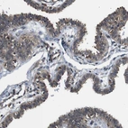 Immunohistochemical staining of human fallopian tube shows moderate cytoplasmic positivity in glandular cells.