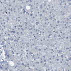 Immunohistochemical staining of human liver shows no cytoplasmic positivity in hepatocytes as expected.
