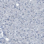 Immunohistochemical staining of human liver shows no cytoplasmic positivity in hepatocytes as expected.