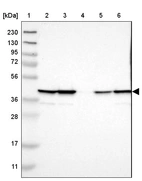 Lane 1: Marker [kDa] 230, 130, 95, 72, 56, 36, 28, 17, 11_br/_Lane 2: Human cell line RT-4_br/_Lane 3: Human cell line U-251MG sp_br/_Lane 4: Human plasma (IgG/HSA depleted)_br/_Lane 5: Human liver tissue_br/_Lane 6: Human tonsil tissue