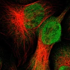 Immunofluorescent staining of human cell line U-2 OS shows localization to nucleoplasm.