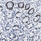 Anti-DACH1 Antibody