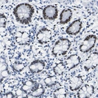 Anti-DACH1 Antibody