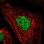 Immunofluorescent staining of human cell line A-431 shows localization to nucleoplasm & vesicles.