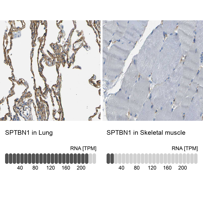 Anti-SPTBN1 Antibody