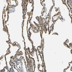 Immunohistochemical staining of human lung shows strong positivity in respiratory epithelial cells.