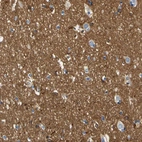 Immunohistochemical staining of human cerebral cortex shows strong positivity in neuropil.