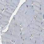 Immunohistochemical staining of human skeletal muscle shows no positivity in myocytes as expected.