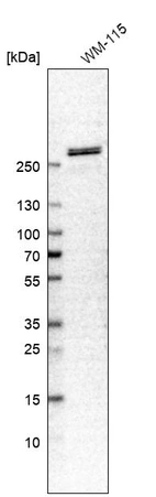 Western blot analysis in human cell line WM-115.