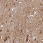 Immunohistochemical staining of human cerebral cortex shows moderate positivity in neuropil, as well as staining in glial cells.