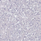 Immunohistochemical staining of human liver shows no positivity in hepatocytes as expected.