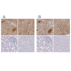 Immunohistochemical staining of human caudate nucleus, cerebral cortex, kidney and liver using Anti-OMG antibody HPA012693 (A) shows similar protein distribution across tissues to independent antibody HPA008206 (B).