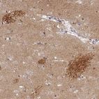 Immunohistochemical staining of human caudate nucleus shows moderate to strong positivity in neuronal processes.