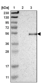 Lane 1: Marker [kDa] 230, 130, 95, 72, 56, 36, 28, 17, 11_br/_Lane 2: Human cell line RT-4_br/_Lane 3: Human cell line U-251MG sp