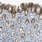 Immunohistochemical staining of human rectum shows strong membranous positivity in glandular cells.