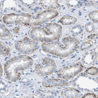 Anti-ITGA6 Antibody