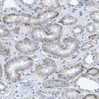Immunohistochemical staining of human kidney shows moderate membranous positivity in cells in tubules.