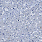 Anti-ITGA6 Antibody