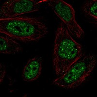 Anti-HIKESHI Antibody