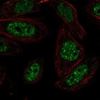 Anti-HIKESHI Antibody