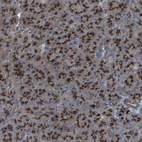 Anti-QSOX2 Antibody