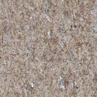 Immunohistochemical staining of human cerebral cortex shows strong cytoplasmic positivity in neuronal processes