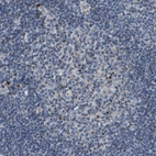 Immunohistochemical staining of human lymph node shows strong cytoplasmic positivity in germinal center cells.