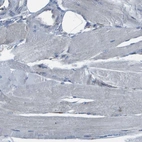 Immunohistochemical staining of human skeletal muscle shows no positivity in myocytes as expected.
