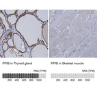 Anti-PPIB Antibody