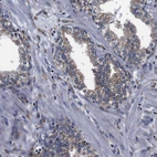 Immunohistochemical staining of human prostate shows weak granular cytoplasmic positivity in glandular cells.