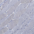 Immunohistochemical staining of human skeletal muscle shows no positivity in myocytes as expected.