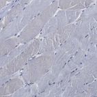 Immunohistochemical staining of human skeletal muscle shows no positivity in myocytes as expected.