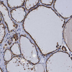 Immunohistochemical staining of human thyroid gland shows strong granular cytoplasmic positivity in glandular cells.