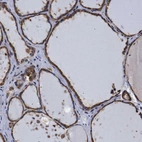 Immunohistochemical staining of human thyroid gland shows strong granular cytoplasmic positivity in glandular cells.