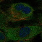 Immunofluorescent staining of human cell line HUVEC TERT2 shows localization to endoplasmic reticulum.