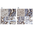 Anti-TGOLN2 Antibody