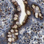 Immunohistochemical staining of human colon using Anti-TGOLN2 antibody HPA012723.