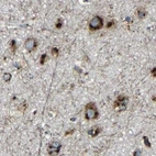 Immunohistochemical staining of human cerebral cortex using Anti-TGOLN2 antibody HPA012723.