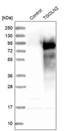 Western blot analysis in control (vector only transfected HEK293T lysate) and TGOLN2 over-expression lysate (Co-expressed with a C-terminal myc-DDK tag (~3.1 kDa) in mammalian HEK293T cells, LY401942).