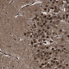 Anti-VCP Antibody
