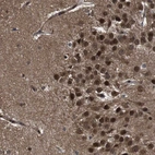 Anti-VCP Antibody