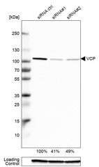 Anti-VCP Antibody